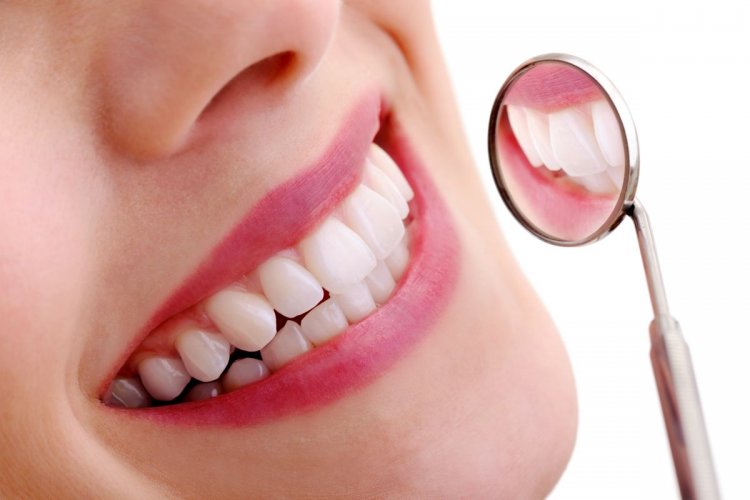 Here's how much a bridge for teeth will cost